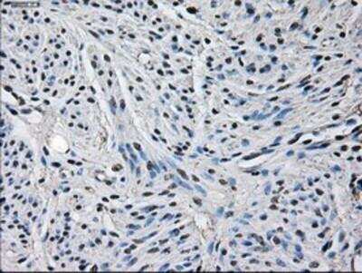 Immunohistochemistry-Paraffin: Glutamine Synthetase Antibody (OTI1F4) [NBP2-02125]
