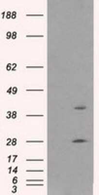 Western Blot: Glutamine Synthetase Antibody (OTI1F4) [NBP2-02125]