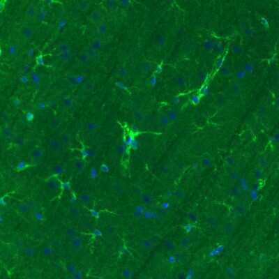 Immunohistochemistry: Glutamine Synthetase Antibody (CL2999) [NBP2-46643]