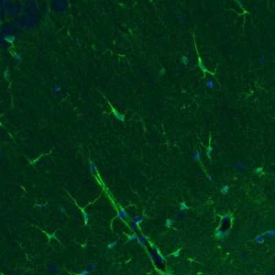 Immunohistochemistry: Glutamine Synthetase Antibody (CL2999) [NBP2-46643]