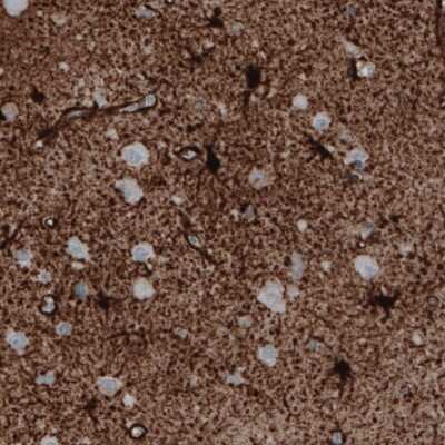 Immunohistochemistry: Glutamine Synthetase Antibody (CL2999) [NBP2-46643]