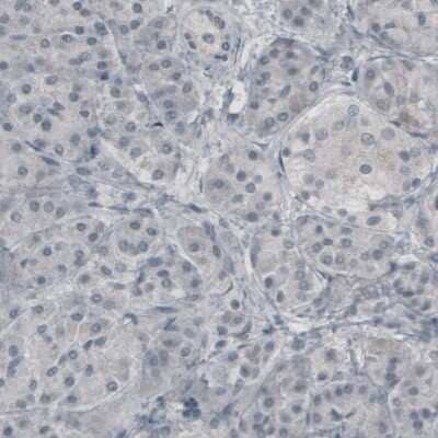 Immunohistochemistry: Glutamine Synthetase Antibody (CL2999) [NBP2-46643]