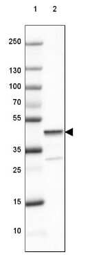 Western Blot: Glutamine Synthetase Antibody (CL2999) [NBP2-46643]