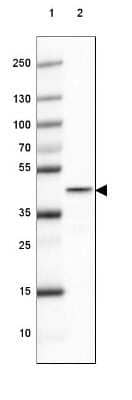 Western Blot: Glutamine Synthetase Antibody (CL2999) [NBP2-46643]