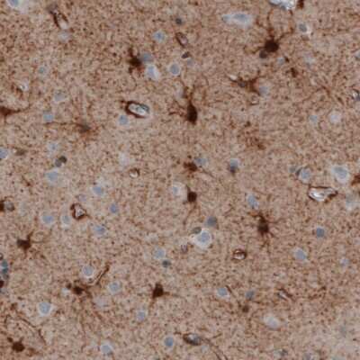 Immunohistochemistry: Glutamine Synthetase Antibody (CL3004) [NBP2-46644]