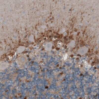 Immunohistochemistry: Glutamine Synthetase Antibody (CL3004) [NBP2-46644]