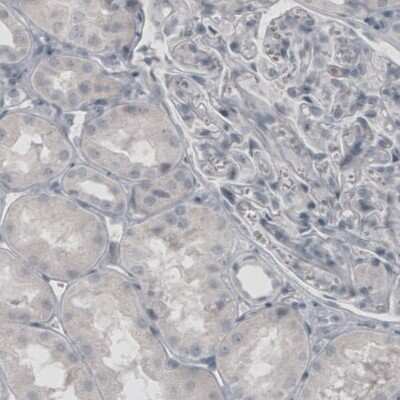 Immunohistochemistry: Glutamine Synthetase Antibody (CL3004) [NBP2-46644]
