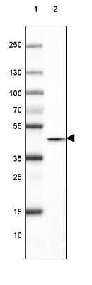 Western Blot: Glutamine Synthetase Antibody (CL3004) [NBP2-46644]