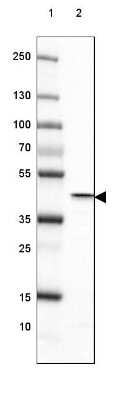 Western Blot: Glutamine Synthetase Antibody (CL3004) [NBP2-46644]