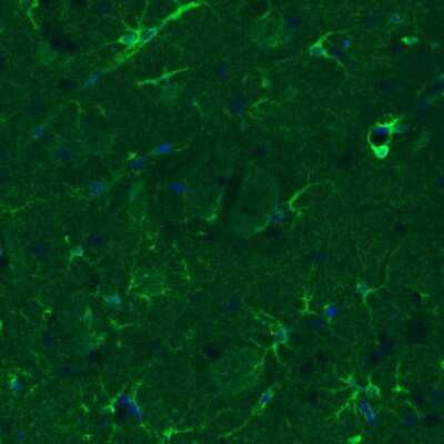 Immunohistochemistry: Glutamine Synthetase Antibody (CL3013) [NBP2-46645]