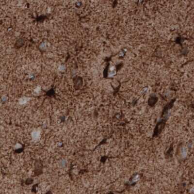 Immunohistochemistry-Paraffin: Glutamine Synthetase Antibody (CL3013) [NBP2-46645]