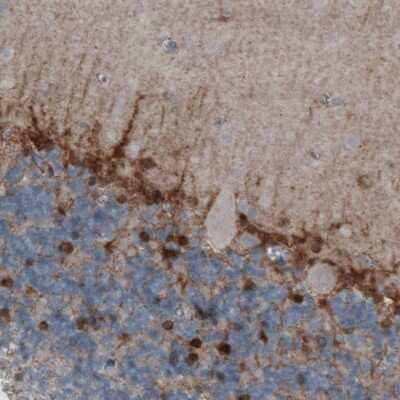 Immunohistochemistry-Paraffin: Glutamine Synthetase Antibody (CL3013) [NBP2-46645]
