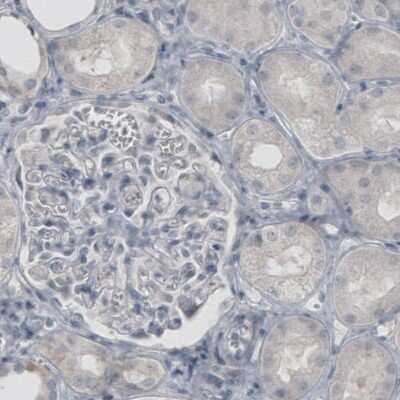 Immunohistochemistry-Paraffin: Glutamine Synthetase Antibody (CL3013) [NBP2-46645]