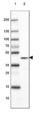 Western Blot: Glutamine Synthetase Antibody (CL3013) [NBP2-46645]