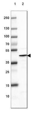 Western Blot: Glutamine Synthetase Antibody (CL3013) [NBP2-46645]