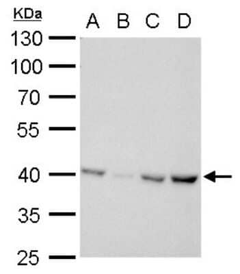 Western Blot: Glutamine Synthetase Antibody (7711) [NBP2-43826]
