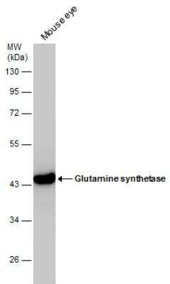 Western Blot: Glutamine Synthetase Antibody (7711) [NBP2-43826]