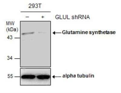 Western Blot: Glutamine Synthetase Antibody (7711) [NBP2-43826]