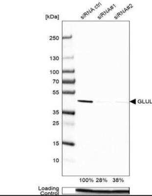 Western Blot: Glutamine Synthetase Antibody (CL3004) [NBP2-46644]