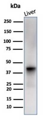 Western Blot: Glutamine Synthetase Antibody (GLUL/6600) [NBP3-13928]