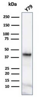 Western Blot: Glutamine Synthetase Antibody (GLUL/6600) [NBP3-13928]