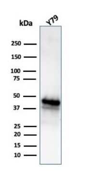 Western Blot: Glutamine Synthetase Antibody (GLUL/6604) [NBP3-13929]