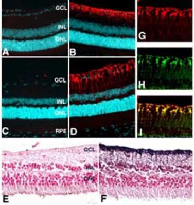 Immunohistochemistry: Glutamine Synthetase Antibody [NB110-41404]
