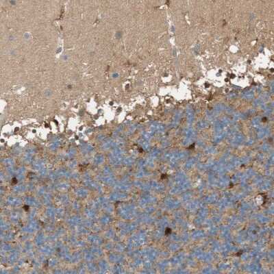 Immunohistochemistry-Paraffin: Glutamine Synthetase Antibody [NBP1-89767]