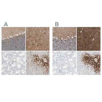 Immunohistochemistry-Paraffin: Glutamine Synthetase Antibody [NBP1-89767]