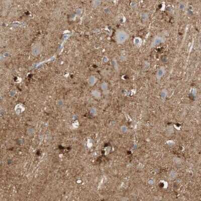 Immunohistochemistry-Paraffin: Glutamine Synthetase Antibody [NBP1-89767]