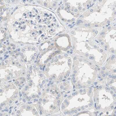 Immunohistochemistry-Paraffin: Glutamine Synthetase Antibody [NBP1-89767]