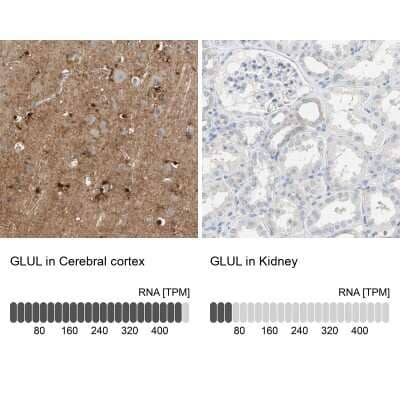 Immunohistochemistry-Paraffin: Glutamine Synthetase Antibody [NBP1-89767]