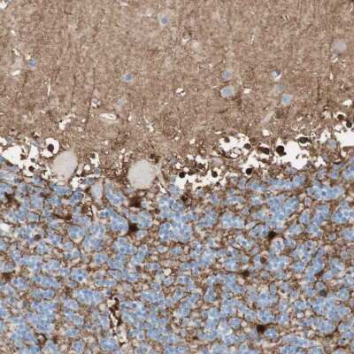 Immunohistochemistry-Paraffin: Glutamine Synthetase Antibody [NBP1-89768]