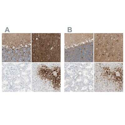 Immunohistochemistry-Paraffin: Glutamine Synthetase Antibody [NBP1-89768]