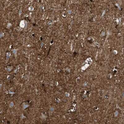Immunohistochemistry-Paraffin: Glutamine Synthetase Antibody [NBP1-89768]