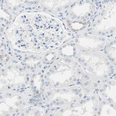 Immunohistochemistry-Paraffin: Glutamine Synthetase Antibody [NBP1-89768]