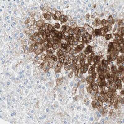 Immunohistochemistry-Paraffin: Glutamine Synthetase Antibody [NBP1-89768]