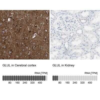 Immunohistochemistry-Paraffin: Glutamine Synthetase Antibody [NBP1-89768]
