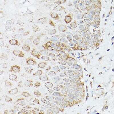 Immunohistochemistry-Paraffin: Glutamine Synthetase Antibody - BSA Free [NBP3-03471]