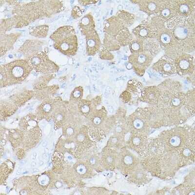 Immunohistochemistry-Paraffin: Glutamine Synthetase Antibody - BSA Free [NBP3-03471]