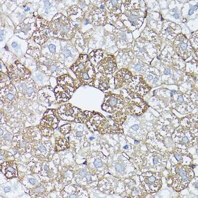 Immunohistochemistry-Paraffin: Glutamine Synthetase Antibody - BSA Free [NBP3-03471]