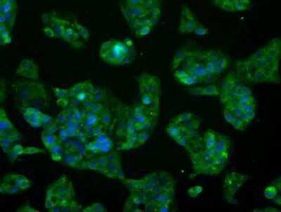 Immunocytochemistry/ Immunofluorescence: Glutamine Synthetase Antibody (OTI1F4) - Azide and BSA Free [NBP2-70834]