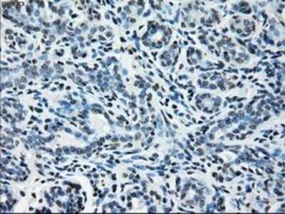 Immunohistochemistry: Glutamine Synthetase Antibody (OTI1F4) - Azide and BSA Free [NBP2-70834]