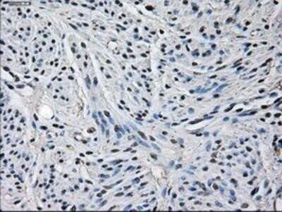 Immunohistochemistry: Glutamine Synthetase Antibody (OTI1F4) - Azide and BSA Free [NBP2-70834]