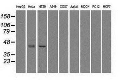 Western Blot: Glutamine Synthetase Antibody (OTI1F4)Azide and BSA Free [NBP2-70834]