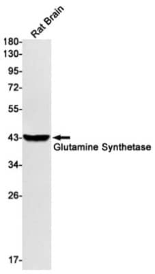 Western Blot: Glutamine Synthetase Antibody (S03-4B6) [NBP3-19535]