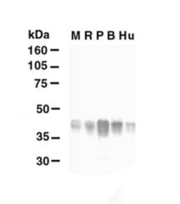 Western Blot: Glutamine Synthetase Antibody [NB110-41404]