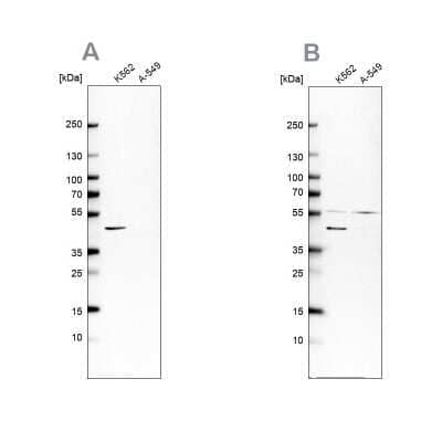 Western Blot: Glutamine Synthetase Antibody [NBP1-89768]