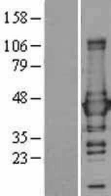 Western Blot: Glutamine Synthetase Overexpression Lysate [NBL1-11130]