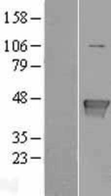 Western Blot: Glutamine Synthetase Overexpression Lysate [NBL1-11132]